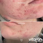 Vitaran 2 - Image 3