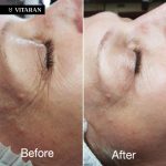  Vitaran 2 - Image 4